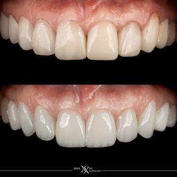 Slider image (5) Jimer Dental Clinics